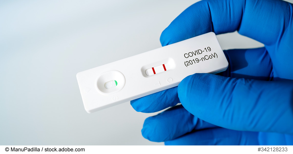 Schnelltests auf Corona: Möglichkeiten zu Hause und von Profis